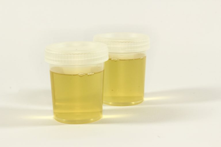 Are digital pregnancy tests simply taking the pee?
