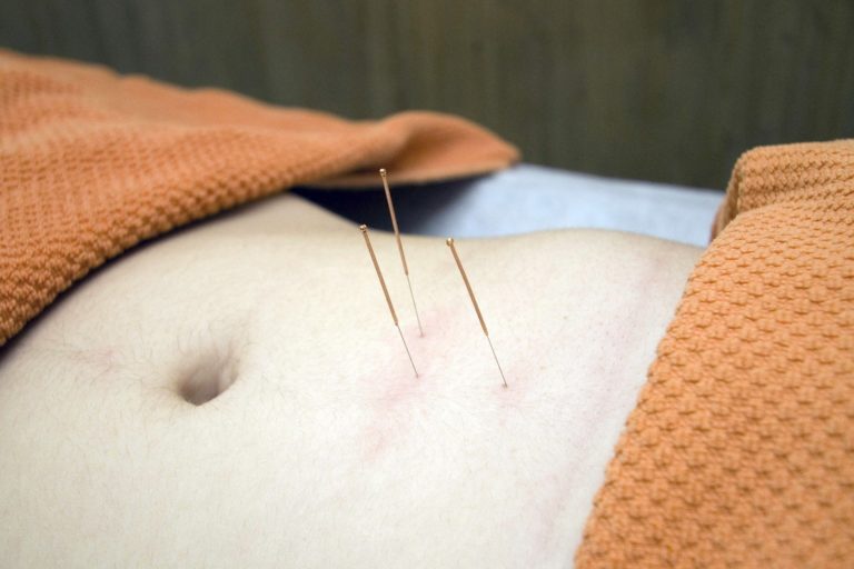 Acupuncture remains one of the most enduring pseudo-therapies – even though it does not work