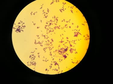 An infectious stage of T gondii viewed down a microscope
