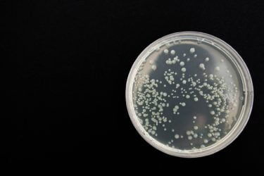 A petri dish with bacterial colonies growing on it. 
