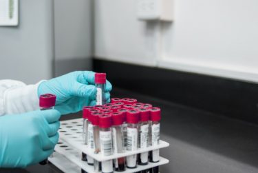 Blood samples in tubes in a rack in a laboratory