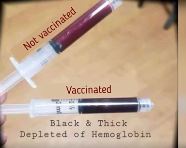 Two syringes apparently filled with blood. One is labelled "not vaccinated" and is red. The other is labelled "vaccinated" and is black. Next to the black syringe is the label "black and thick, depleted of hemoglobin"