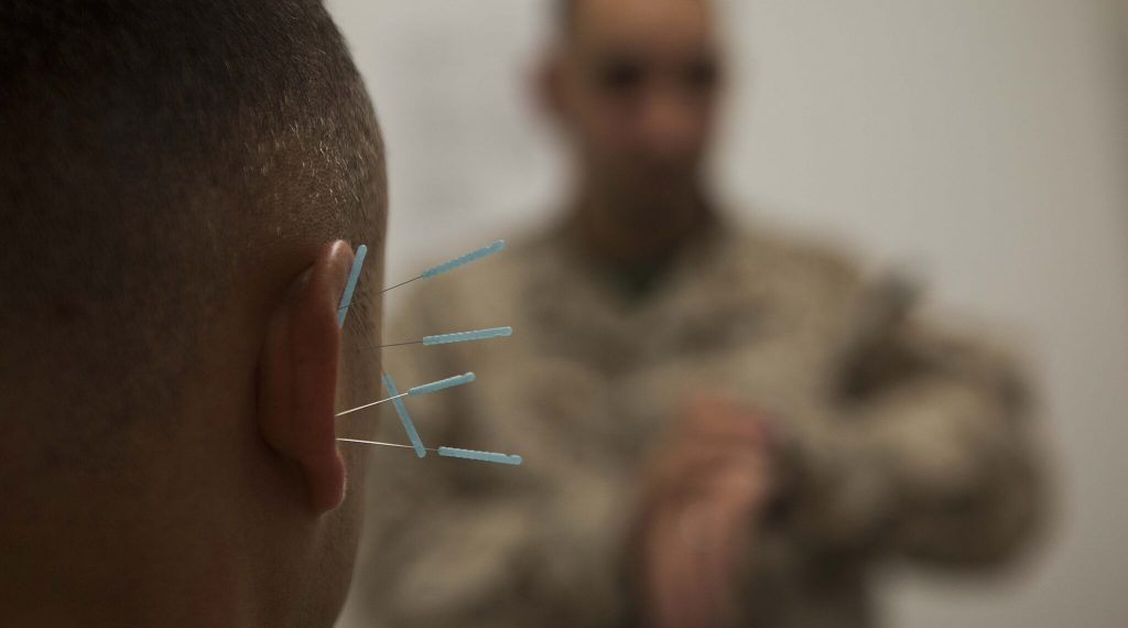 Close-up image taken from behind someone's head of six blue-handled thin needles stuck into their ear at various points. in front of them is an out-of-focus military man looking at his watch.