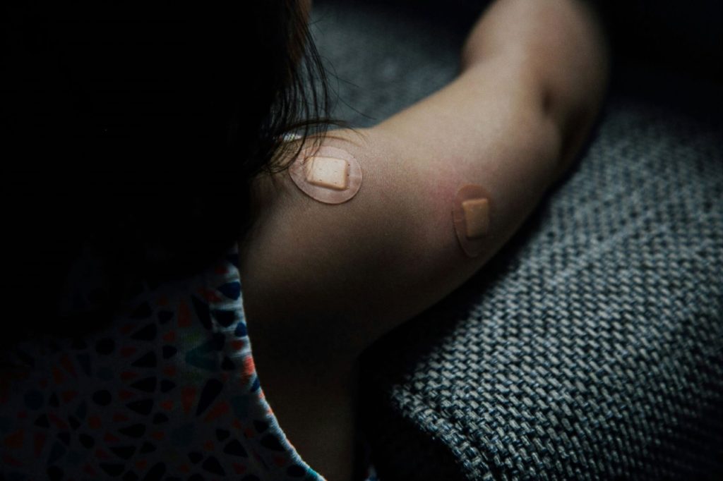 A child with long, dark hair, rests their arm outstretched on a woven furniture surface. They have two round plasters on their shoulder and upper arm.