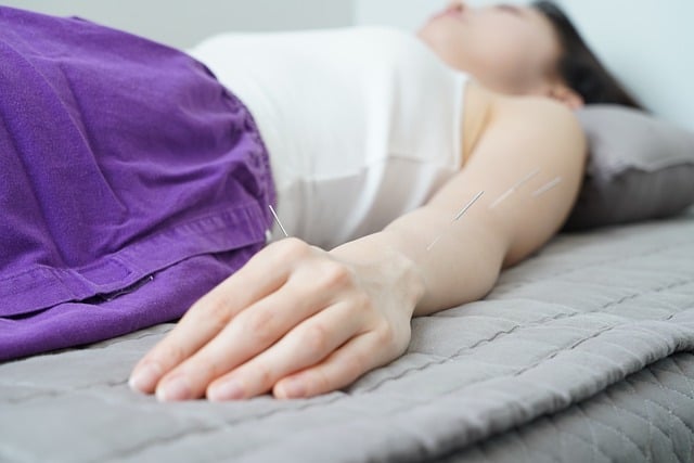 A photograph of an Asian woman lying on a couch, with acupuncture needles in her hand and arm,