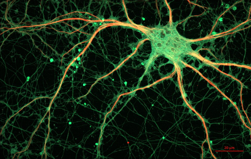 Sprawling orange/green tendrils between green nodes on a black background.