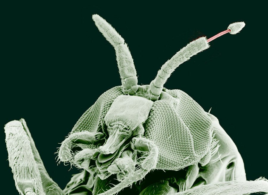 Electron microscope image of a fly's head, showing the fly in bright black and white against a black background. The fly's mouth and compound eyes are seen in detail. A thin strand is emerging from the end of the fly's left antenna.